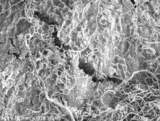 炭化水素から合成された炭素材料の電子顕微鏡写真